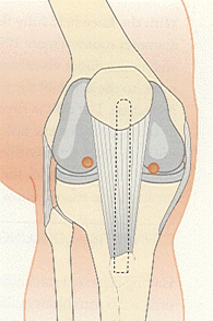      Acl4.gif